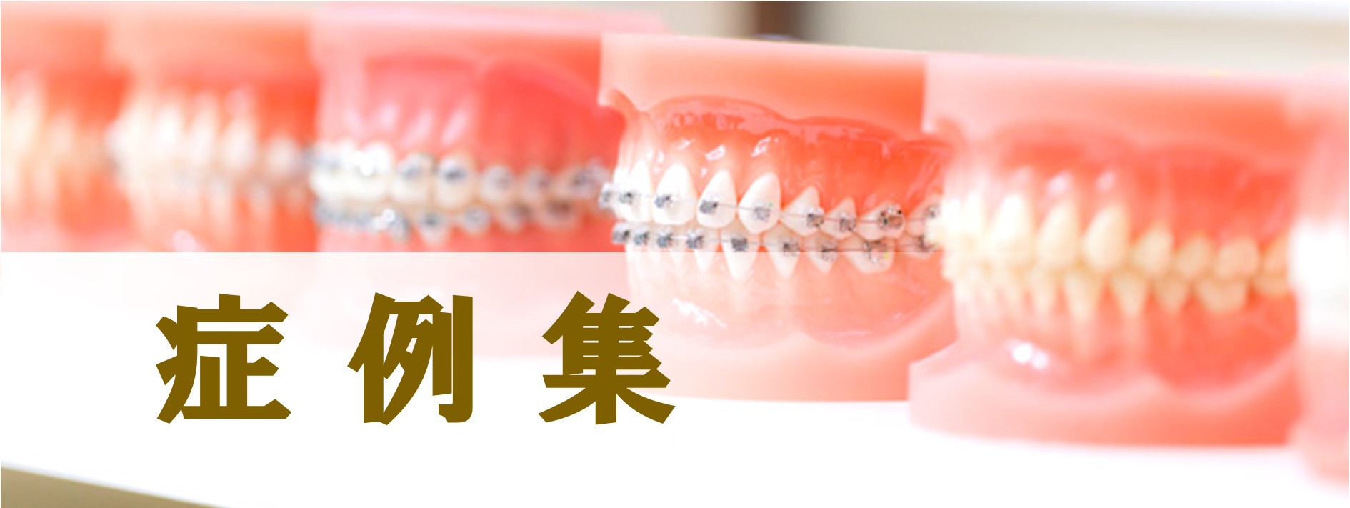 症例集
