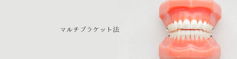 マルチブラケット法