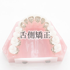 舌側矯正